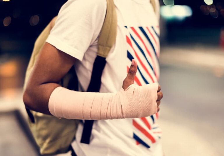 Ein junger Mann hat einen gebrochenen Arm und hat dadurch eine Krankheit in der Probezeit